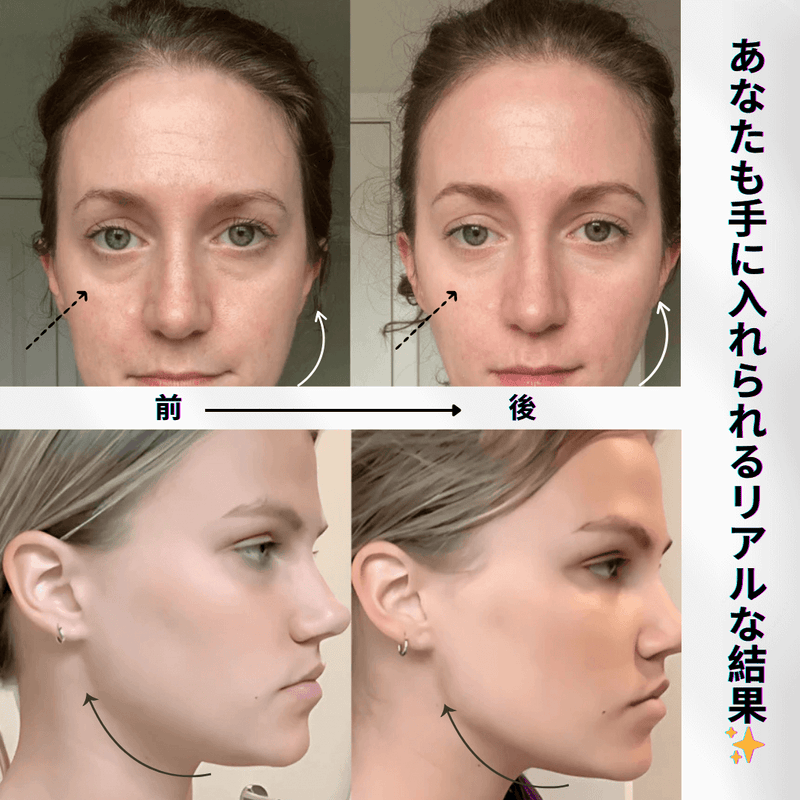 LumiSkin Pro™リフトフェイスデバイ+ ebook